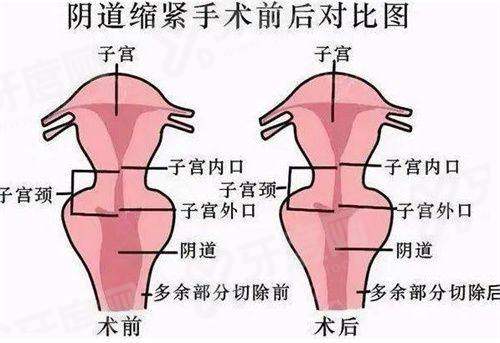 深圳联合丽格医疗美容部可靠吗？鼻整形与眼修复口碑佳，医生技术精湛服务贴心
