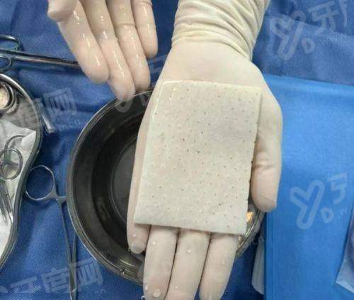 二、深圳联合丽格医疗美容部口碑怎么样？yanke.yadoo.cn
