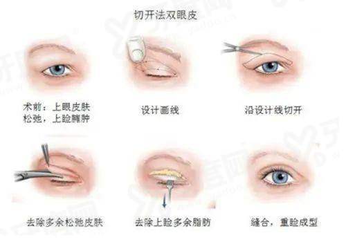 深圳联合丽格医疗美容部营业时间公布：微创双眼皮技术精湛恢复快效果自然持久