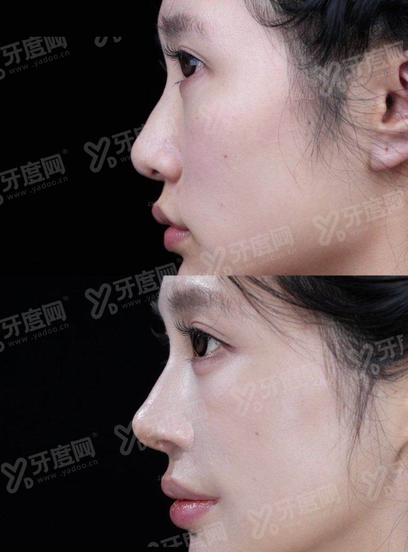 深圳联合丽格医疗美容部收费标准如何？院内特色抗衰技术显著/医生团队经验丰富