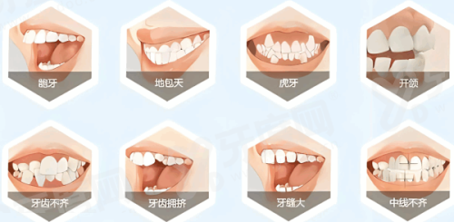 东莞好佰年口腔部收费标准？种植牙 2980+矫正 4800 元起透明价目表