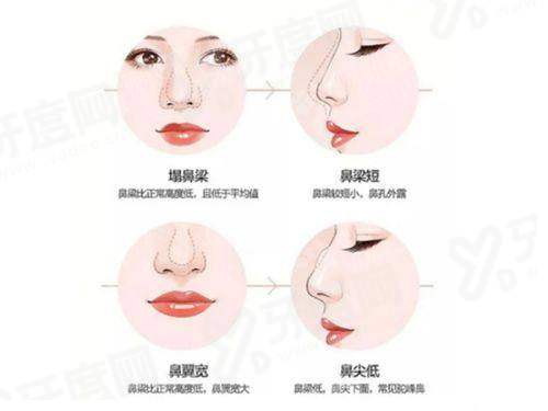 一、深圳宝丽医疗美容门诊部技术好吗？综合实力强，技术优势明显！yanke.yadoo.cn