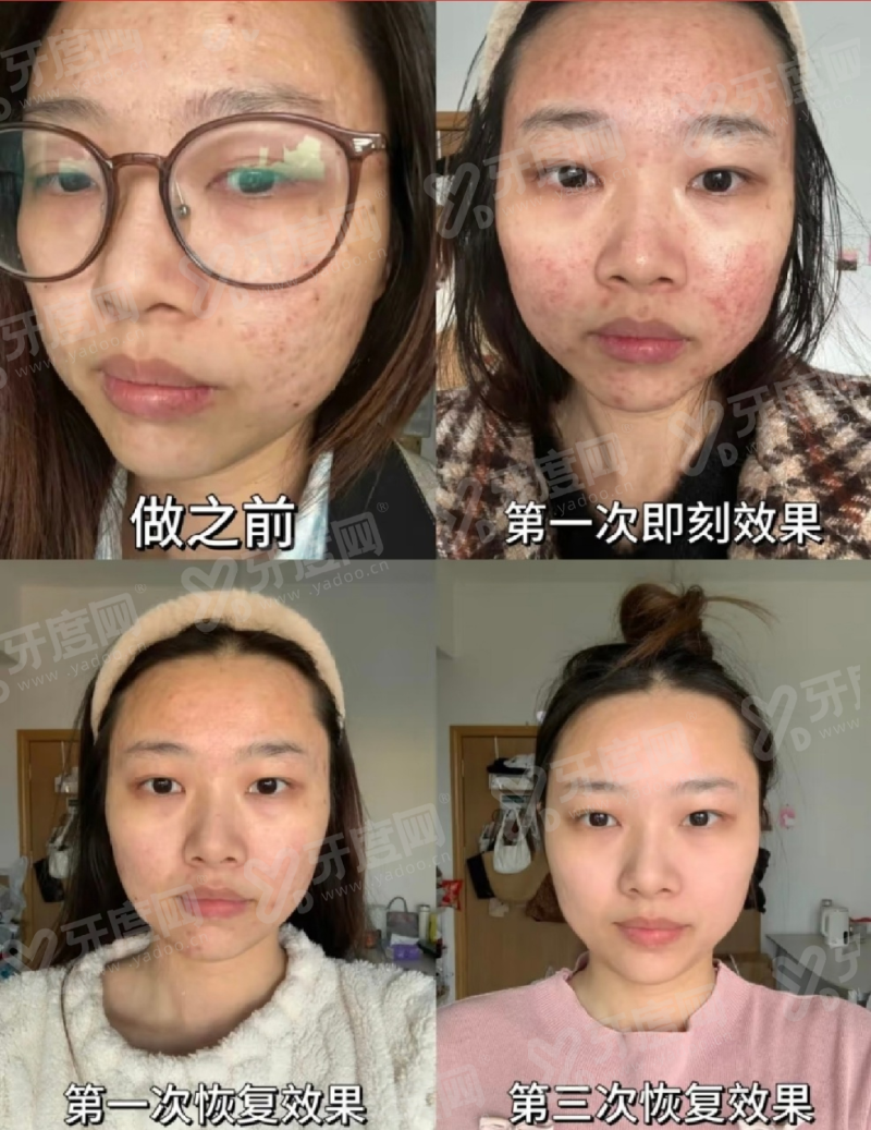 东莞壹加壹整形美容医院地址在哪里？正规机构名医亲诊技术靠谱变美安心