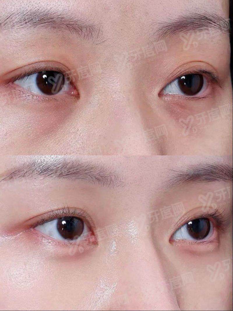 三、在东莞壹加壹做整形大概多少钱及怎么预约？yanke.yadoo.cn