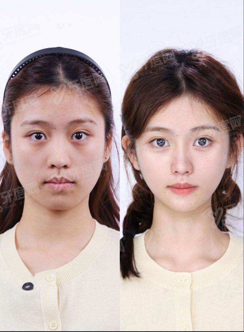 一、深圳宝丽医疗美容门诊部预约挂号？（专精团队+贴心服务，轻松搞定预约）yanke.yadoo.cn