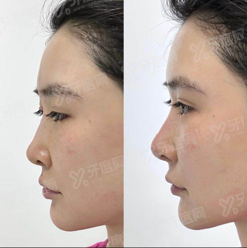 东莞壹加壹整形美容医院正规吗？资质齐全医生技术精湛，口碑认证安心变美