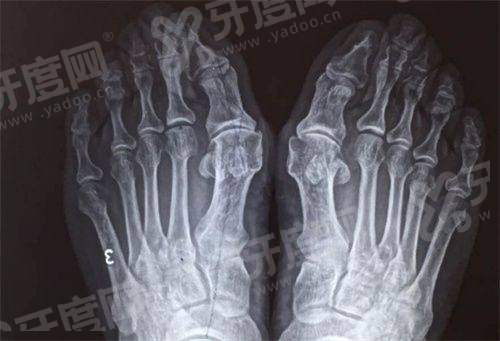 夏志冉医生面部提升怎么样？分层抗衰技术自然，坐诊医院正规可查
