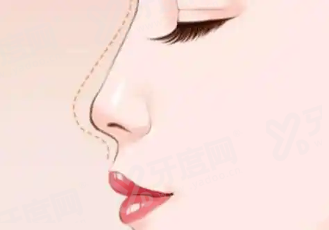 二、上海碧莲盛张鹏程植发价格表yanke.yadoo.cn