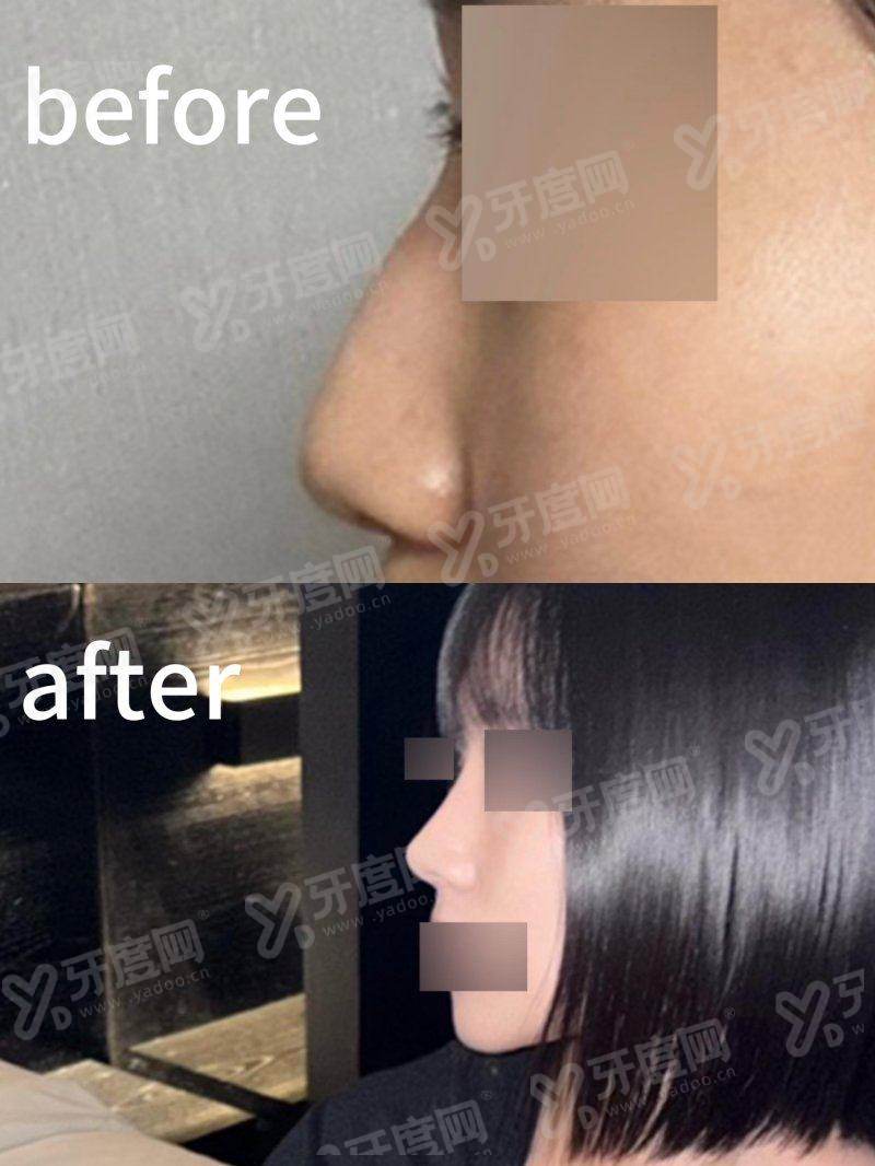 二、上海江城皮肤医院怎么样yanke.yadoo.cn