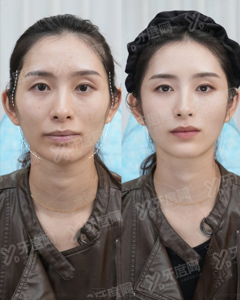 三、上海汇壹美整形医院地址电话yanke.yadoo.cn