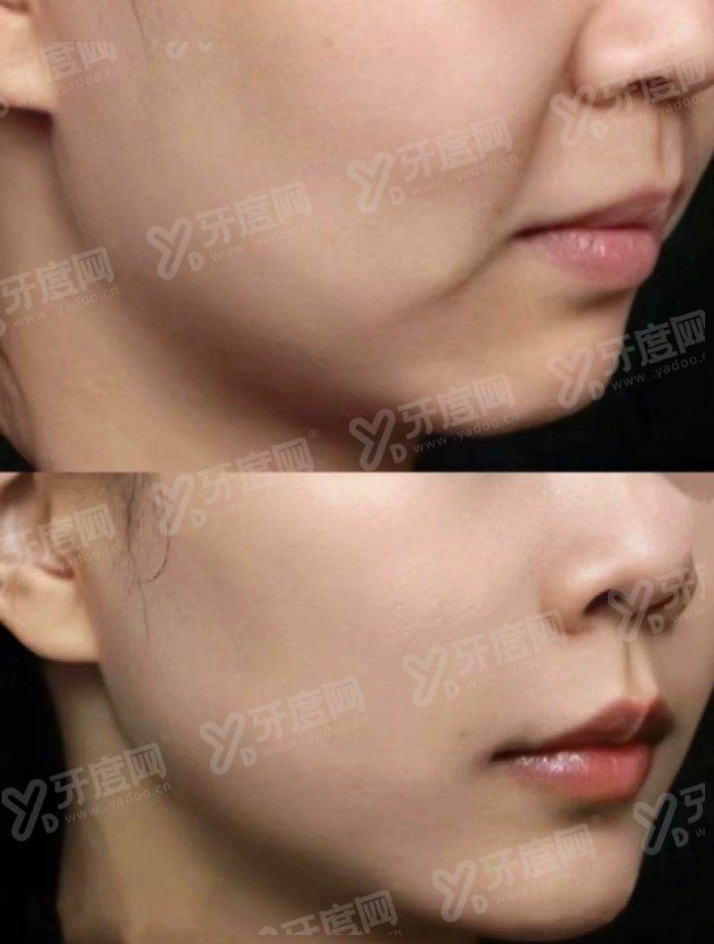 三、上海悦欧医疗美容医院价格表yanke.yadoo.cn