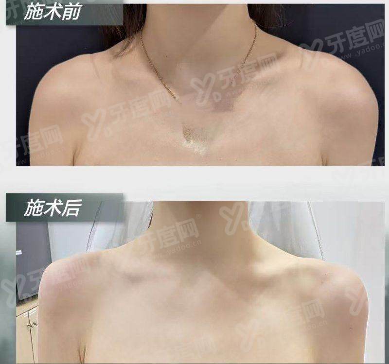 二、上海安达医院男科价格表yanke.yadoo.cn