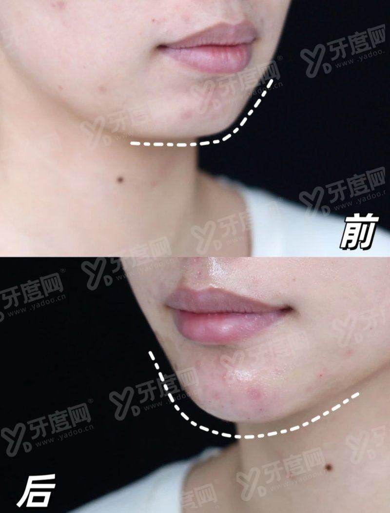 上海安达医院男科怎么样?男科技术靠谱，附详细价格表与地址电话指南