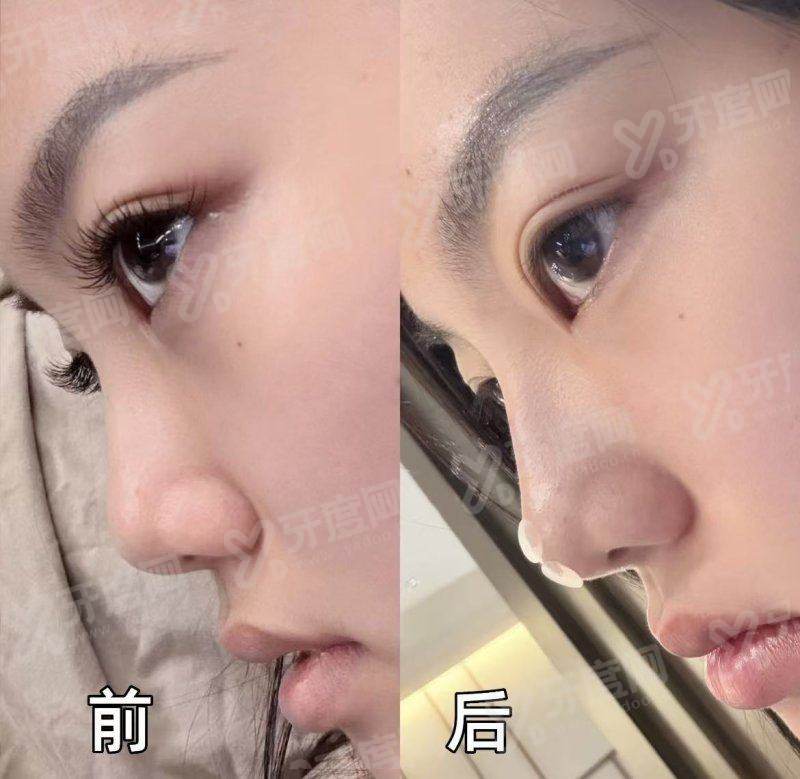 上海悦欧医疗美容医院地址电话：在静安区，附详细地址+价格表