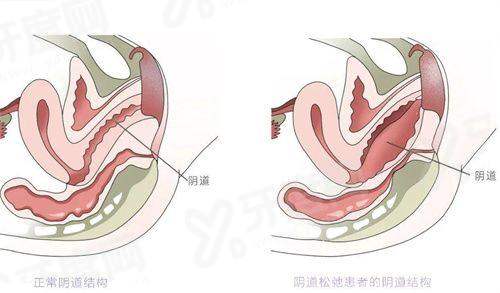 三、柳州微美医疗美容医院怎么样yanke.yadoo.cn