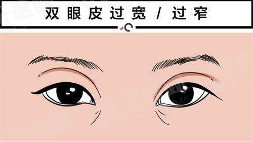 二、柳州微美医疗美容医院价格表yanke.yadoo.cn