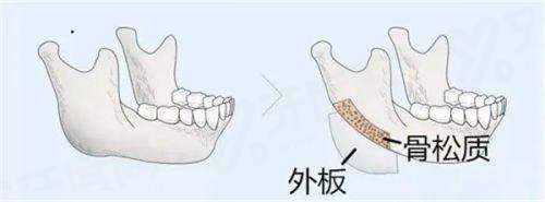 柳州微美医疗美容医院如何预约挂号？正规机构技术靠谱，附价格表与地址电话全攻略