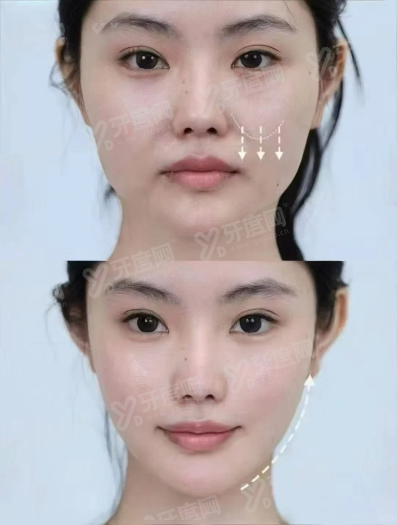 小结