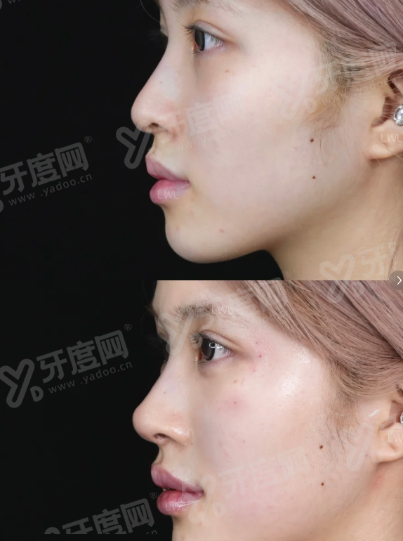 北京爱颜医疗美容医院地址在哪里？在朝阳区，整形效果自然