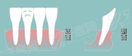 二、哈尔滨双燕医美价格表yanke.yadoo.cn