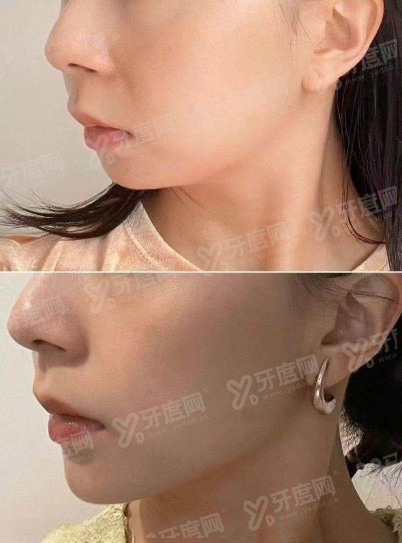 厦门福华医疗美容诊所的地址在哪？正规机构技术靠谱预约方便