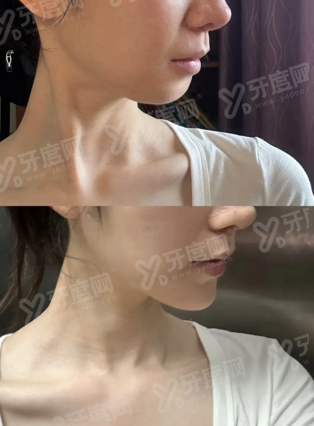 海南三亚星悦荟医疗美容怎么样？正规机构技术靠谱附地址电话