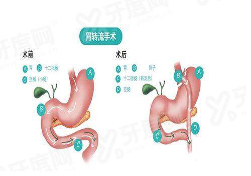 一、宁波碧莲盛植发医院如何挂号预约yanke.yadoo.cn