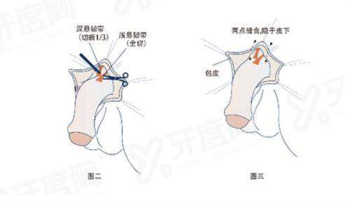 二、青岛博士医疗美容医院怎么样?真实实例分享yanke.yadoo.cn