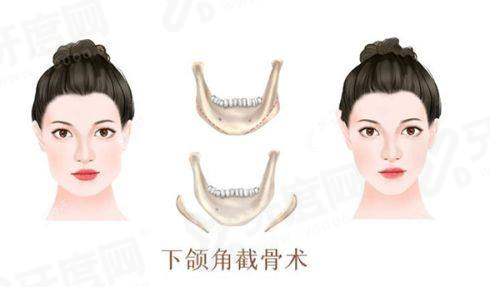 二、北京韶华医疗美容医院怎么样yanke.yadoo.cn