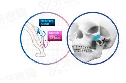 北京韶华医疗美容医院如何预约挂号？3种预约方式+价格表+地址路线公布