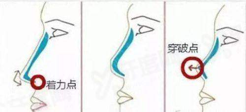 三、丹东诗莉花医疗美容医院地址在哪里yanke.yadoo.cn