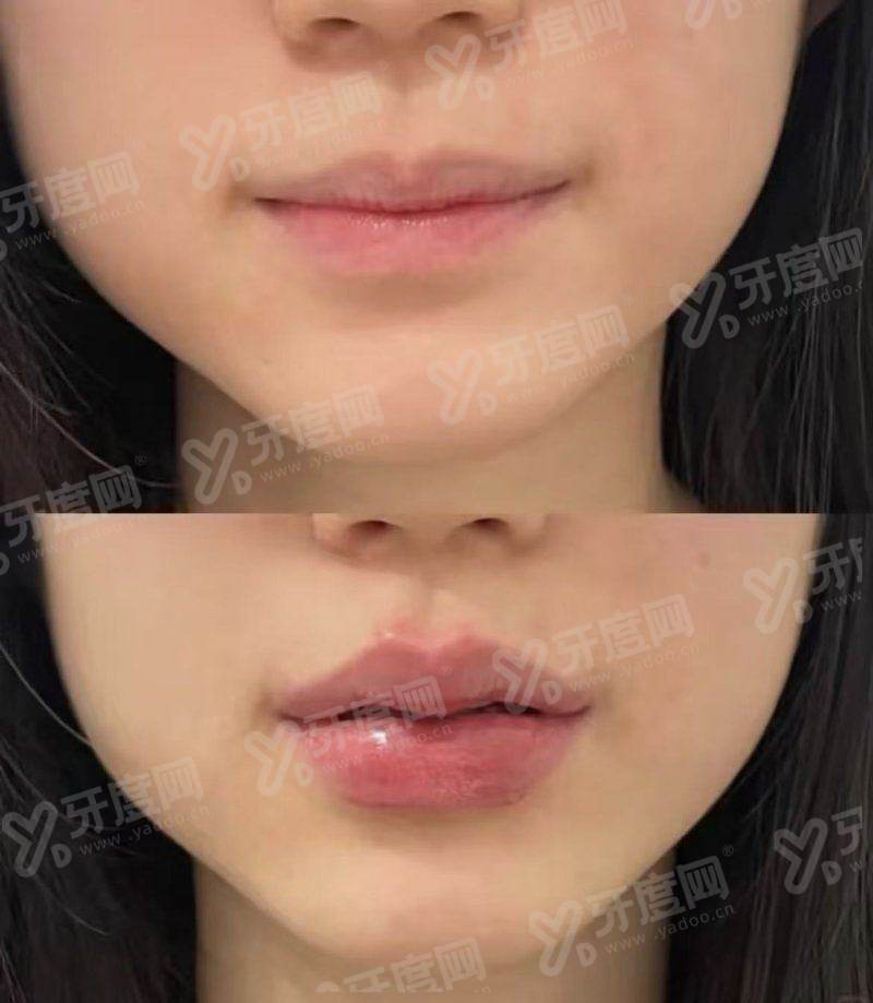 北京韶华医疗美容医院怎么样？正规二级整形医院，效果自然价格不贵