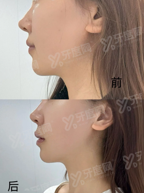 丹东诗莉花医疗美容医院评价怎么样？技术靠谱，整形口碑自然