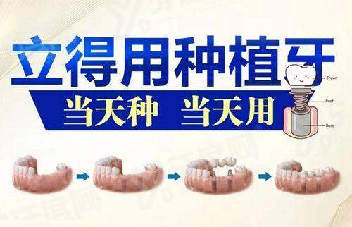 二、珠江医院脊柱微创费用合理吗yanke.yadoo.cn