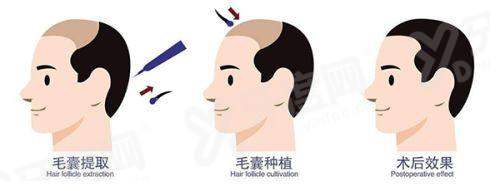 三、武汉正璞医疗美容医院地址在哪里yanke.yadoo.cn
