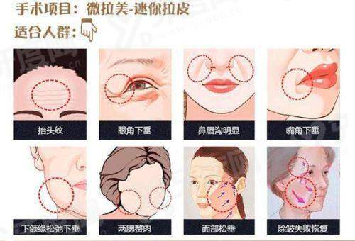 2026上海天大医疗美容医院价格表：双眼皮3980+玻尿酸填充2200+附地址