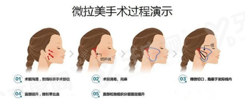 二、西安西美整形医院价格表yanke.yadoo.cn