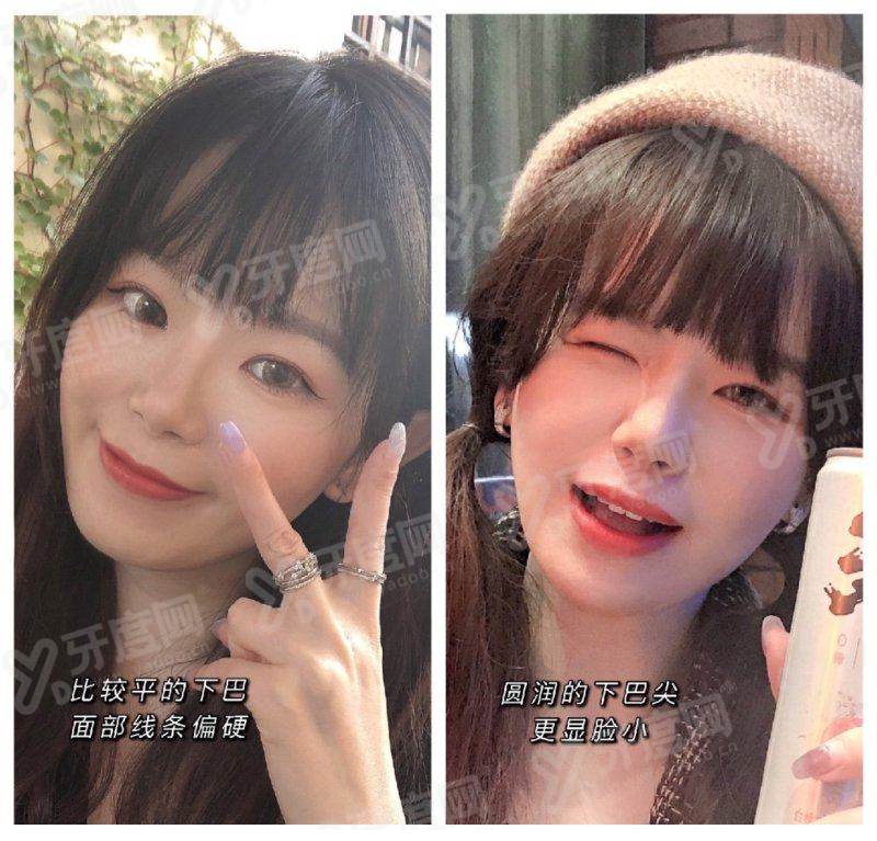 北京孙波舒适吸脂怎么预约挂号？3种挂号方式，孙波手法细腻痛感低恢复快