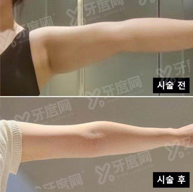 三、北京孙波吸脂地址在哪yanke.yadoo.cn
