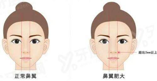 三、袁强博士拉皮手术坐诊地址yanke.yadoo.cn