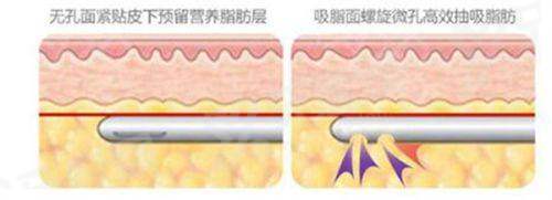 三、上海天大医疗美容医院价格表yanke.yadoo.cn