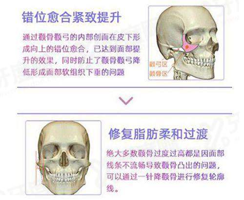 袁强博士在北京联合丽格出诊时间：地址在朝阳区，拉皮技术效果自然