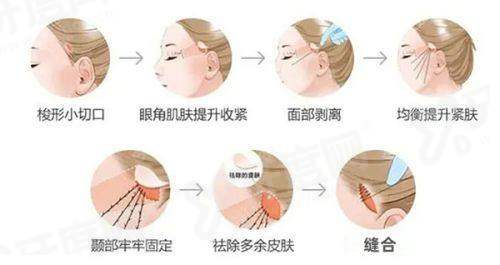 上海天大医疗美容医院怎么样？正规机构技术靠谱，价格表透明地址好找