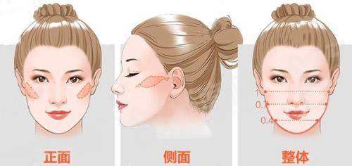 三、北京孙波吸脂塑形如何挂号预约yanke.yadoo.cn