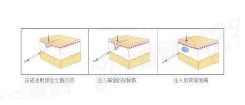 三、找蒋铮铮医生面诊多少钱？怎么预约挂号？yanke.yadoo.cn