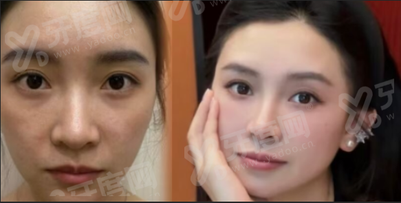二、找蒋铮铮医生做面部年轻化靠谱吗？擅长哪些项目？yanke.yadoo.cn