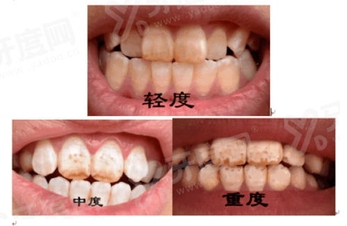 三、威海中诺口腔地址交通指南yanke.yadoo.cn