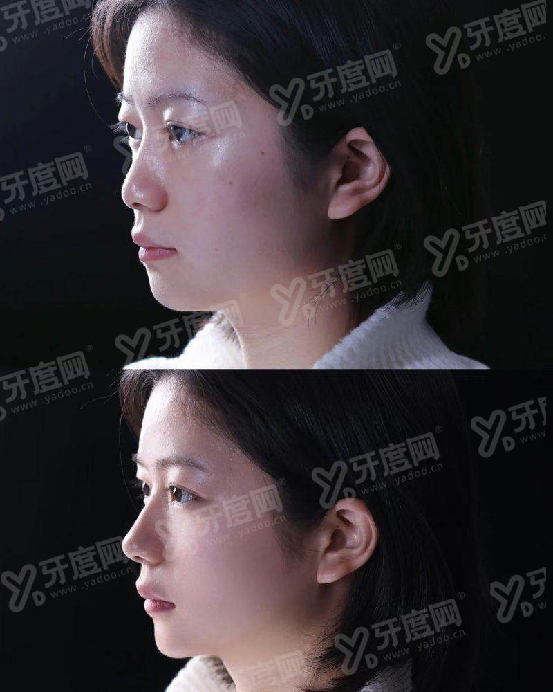 小结：价格透明，丰俭由人yanke.yadoo.cn