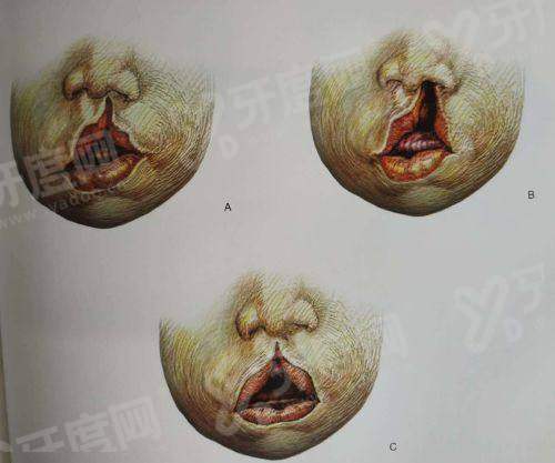 三、想找陈雄医生面诊手术该怎么预约挂号？yanke.yadoo.cn