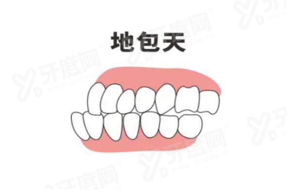 杭州杭里口腔全口即刻种植牙多少钱？2026看牙补贴大公开，2000起一颗